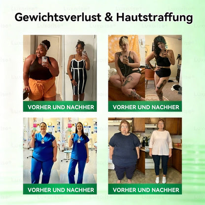 🌐Neu eingetroffen✅𝑳𝒖𝒙𝒂𝒓𝒊𝒔𝒆® 10-in-1 pflanzliches Pflegekonzept