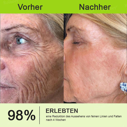 Jetzt jugendliche Haut zurückgewinnen 🍀Rolimey® Botox & Vita-A Retinol Shot Falten-Lift Straffungscreme