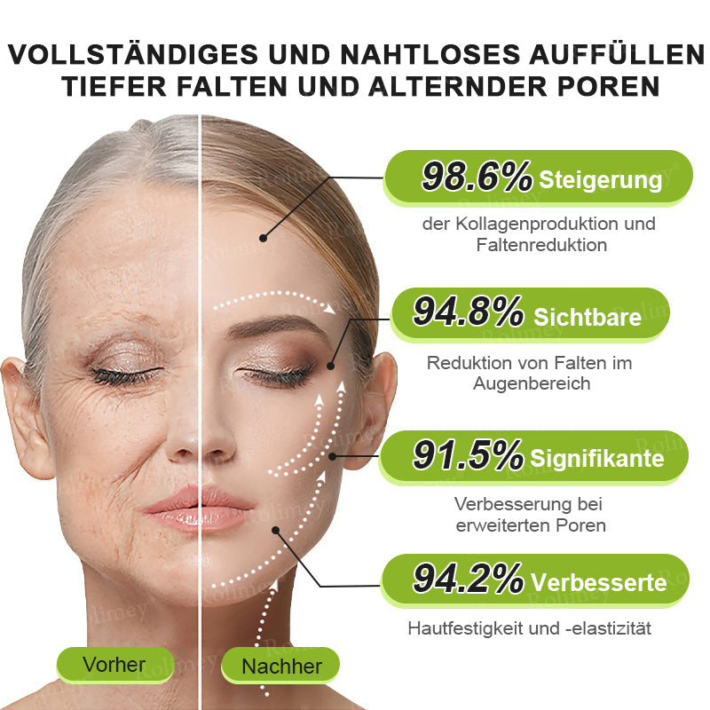 Jetzt jugendliche Haut zurückgewinnen 🍀Rolimey® Botox & Vita-A Retinol Shot Falten-Lift Straffungscreme