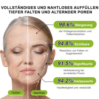 Jetzt jugendliche Haut zurückgewinnen 🍀Rolimey® Botox & Vita-A Retinol Shot Falten-Lift Straffungscreme