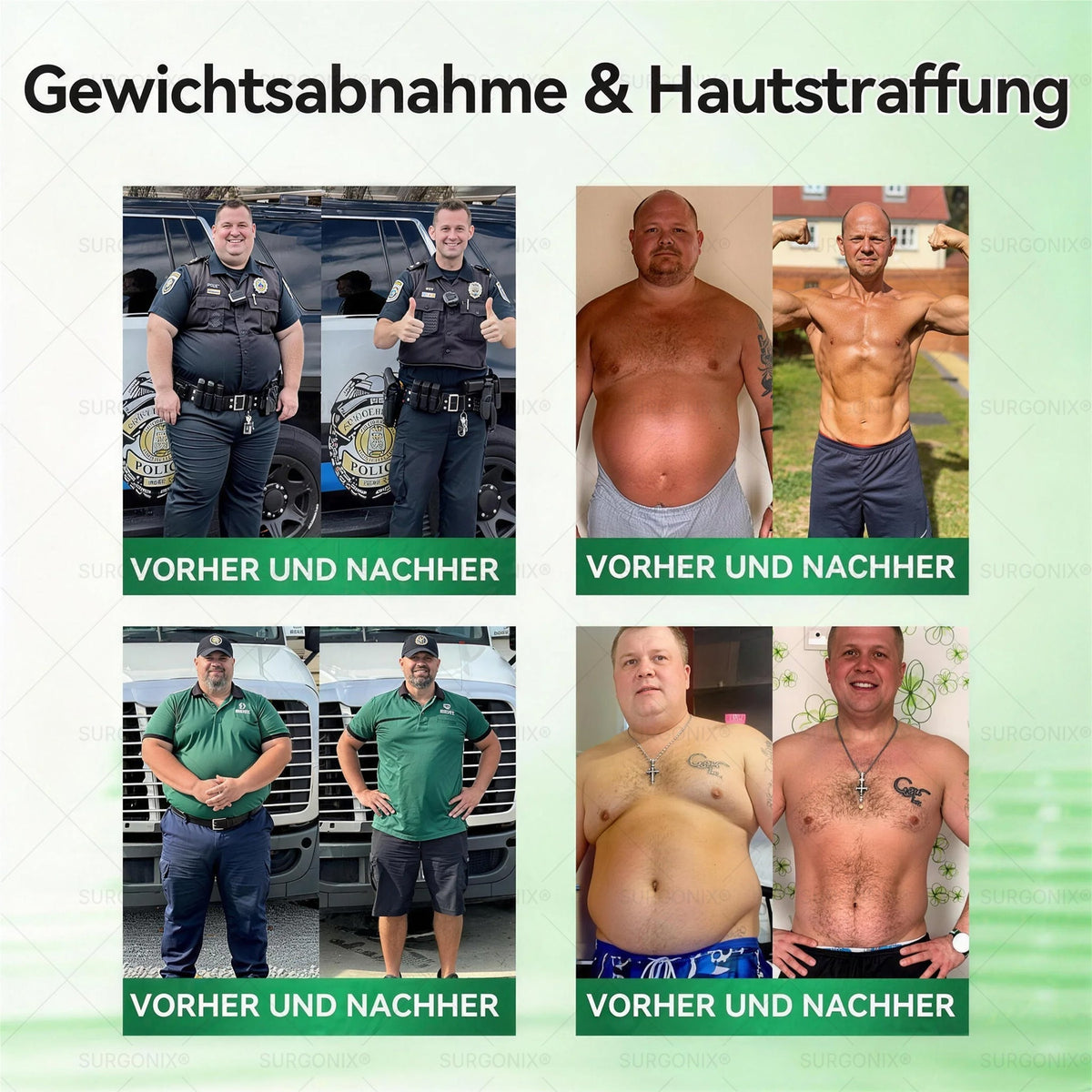 Surgoᴎix® 🛒 50 % Rabatt für kurze Zeit – Gesponsert von dm