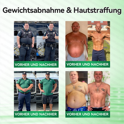 🇩🇪𝐎𝐟𝐟𝐢𝐳𝐢𝐞𝐥𝐥𝐞𝐫 𝐒𝐡𝐨𝐩 | 🌈🌈 𝑮𝑳𝑶𝐑𝐄𝐍𝐃𝘼®𝙈𝙤𝙧𝙞𝙣𝗴𝗮 · 𝗕𝗲𝗿𝗯𝗲𝗿𝒊𝒏 × 𝑵𝘼𝘿+ 10-𝙞𝙣-𝟏 𝐀𝐝𝐯𝐚𝗻𝗰𝗲𝗱 𝗡𝗮𝙣𝙤 𝙈𝙞𝙠𝙧𝐨𝐧𝐚𝐝𝐞𝐥-𝐏𝐚𝒕𝒄𝗵(𝐍𝐮𝐫 𝐞𝐢𝐧𝐦𝐚𝐥 𝐭ä𝐠𝐥𝐢𝐜𝐡, 𝐬𝐢𝐜𝐡𝐭𝐛𝐚𝐫𝐞 𝐕𝐞𝐫ä𝐧𝐝𝐞𝐫𝐮𝐧𝐠𝐞𝐧 𝐢𝐧 𝟕 𝐓𝐚𝐠𝐞𝐧)✅ 𝐅ü𝐫 𝐅𝐞𝐭𝐭𝐥𝐞𝐢𝐛𝐢𝐠𝐤𝐞𝐢𝐭, 𝐇𝐚𝐮𝐭𝐬𝐭𝐫𝐚𝐟𝐟𝐮𝐧𝐠, 𝐃𝐢𝐚𝐛𝐞𝐭𝐞𝐬, 𝐒𝐜𝐡𝐥𝐚𝐟𝐚𝐩𝐧𝐨𝐞, 𝐆𝐞𝐥𝐞𝐧𝐤𝐩𝐫𝐨𝐛𝐥𝐞𝐦𝐞 𝐮𝐧𝐝 𝐦𝐞𝐡𝐫!