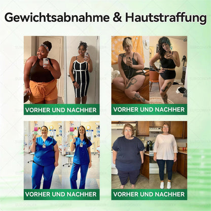 Surgoᴎix® 🛒 50 % Rabatt für kurze Zeit – Gesponsert von dm
