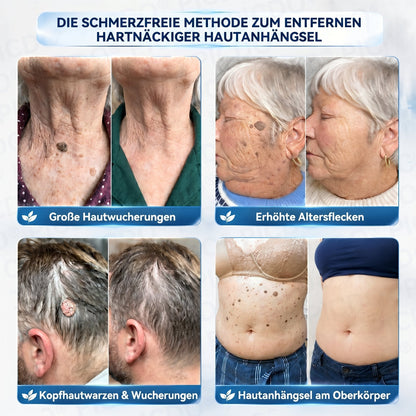 𝐏𝐢𝐜𝐝𝐨® 𝟕-𝐓𝐚𝐠𝐞 𝐇𝐚𝐮𝐭𝐚𝐧𝐡ä𝐧𝐠𝐬𝐞𝐥- & 𝐅𝐥𝐞𝐜𝐤𝐞𝐧-𝐄𝐧𝐭𝐟𝐞𝐫𝐧𝐮𝐧𝐠𝐬𝐜𝐫𝐞𝐦𝐞(𝐒𝐜𝐡𝐦𝐞𝐫𝐳𝐟𝐫𝐞𝐢𝐞 𝐅𝐨𝐫𝐦𝐞𝐥 – 𝐨𝐡𝐧𝐞 𝐍𝐚𝐫𝐛𝐞𝐧) 🎄