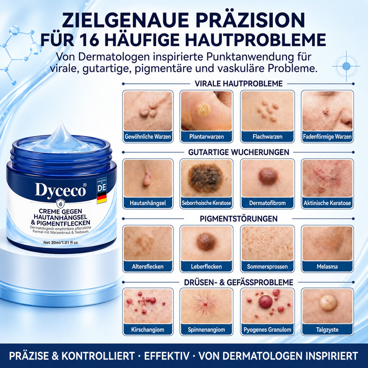 Dyceco® 🚑𝟕-𝐓𝐚𝐠𝐞 𝐇𝐚𝐮𝐭𝐚𝐧𝐡ä𝐧𝐠𝐬𝐞𝐥- & 𝐅𝐥𝐞𝐜𝐤𝐞𝐧-𝐄𝐧𝐭𝐟𝐞𝐫𝐧𝐮𝐧𝐠𝐬𝐜𝐫𝐞𝐦𝐞(𝐒𝐜𝐡𝐦𝐞𝐫𝐳𝐟𝐫𝐞𝐢𝐞 𝐅𝐨𝐫𝐦𝐞𝐥 – 𝐨𝐡𝐧𝐞 𝐍𝐚𝐫𝐛𝐞𝐧)