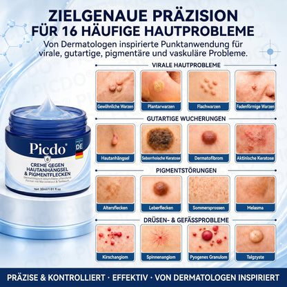 𝐏𝐢𝐜𝐝𝐨® 𝟕-𝐓𝐚𝐠𝐞 𝐇𝐚𝐮𝐭𝐚𝐧𝐡ä𝐧𝐠𝐬𝐞𝐥- & 𝐅𝐥𝐞𝐜𝐤𝐞𝐧-𝐄𝐧𝐭𝐟𝐞𝐫𝐧𝐮𝐧𝐠𝐬𝐜𝐫𝐞𝐦𝐞(𝐒𝐜𝐡𝐦𝐞𝐫𝐳𝐟𝐫𝐞𝐢𝐞 𝐅𝐨𝐫𝐦𝐞𝐥 – 𝐨𝐡𝐧𝐞 𝐍𝐚𝐫𝐛𝐞𝐧) 🎄