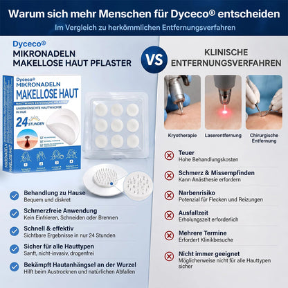👩‍⚕️💕𝑶𝒇𝒇𝒊𝒛𝒊𝒆𝒍𝒍𝒆𝒓 𝑺𝒕𝒐𝒓𝒆 | Dyceco® 🍁 𝑴𝒊𝒌𝒓𝒐𝒏𝒂𝒅𝒆𝒍𝒏 𝑴𝒂𝒌𝒆𝒍𝒍𝒐𝒔𝒆 𝑯𝒂𝒖𝒕 𝑾𝒂𝒓𝒛𝒆 𝑬𝒏𝒕𝒇𝒆𝒓𝒏𝒖𝒏𝒈 𝑷𝒇𝒍𝒂𝒔𝒕𝒆𝒓 (𝐹ü𝑟 𝐻𝑎𝑢𝑡𝑎𝑛ℎä𝑛𝑔𝑠𝑒𝑙, 𝑘𝑙𝑒𝑖𝑛𝑒 𝐻𝑎𝑢𝑡𝑤𝑢𝑐ℎ𝑒𝑟𝑢𝑛𝑔𝑒𝑛, 𝑊𝑎𝑟𝑧𝑒𝑛, 𝑀𝑢𝑡𝑡𝑒𝑟𝑚𝑎𝑙𝑒, 𝐴𝑙𝑡𝑒𝑟𝑠𝑓𝑙𝑒𝑐𝑘𝑒𝑛 𝑢𝑛𝑑 𝑃𝑖𝑔𝑚𝑒𝑛𝑡𝑠𝑡ö𝑟𝑢𝑛𝑔𝑒𝑛.)