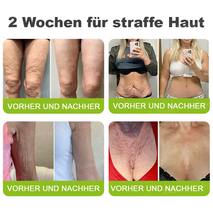 Jetzt jugendliche Haut zurückgewinnen 🍀Rolimey® Botox & Vita-A Retinol Shot Falten-Lift Straffungscreme