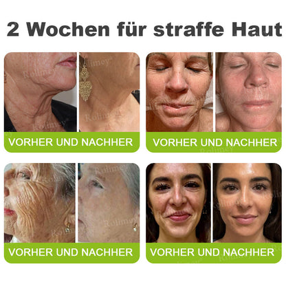 Jetzt jugendliche Haut zurückgewinnen 🍀Rolimey® Botox & Vita-A Retinol Shot Falten-Lift Straffungscreme